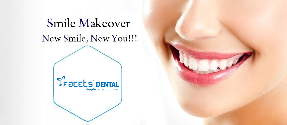 smile-makeover